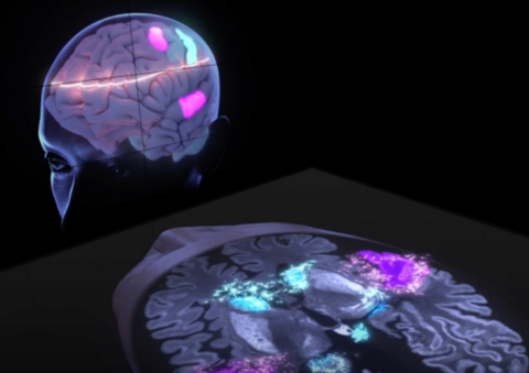 Notes to Neurons Notes to Neurons exhibit